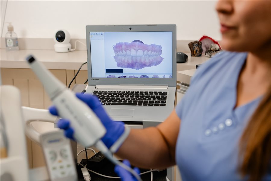 Escáner intraoral digital